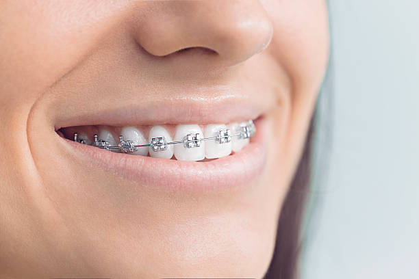 Best Root Canal Treatment  in Lake Mawk, OH